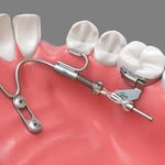 benefit_applications